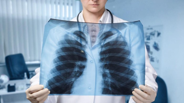 Dokter Bagikan Cara Bersihkan Paru-paru